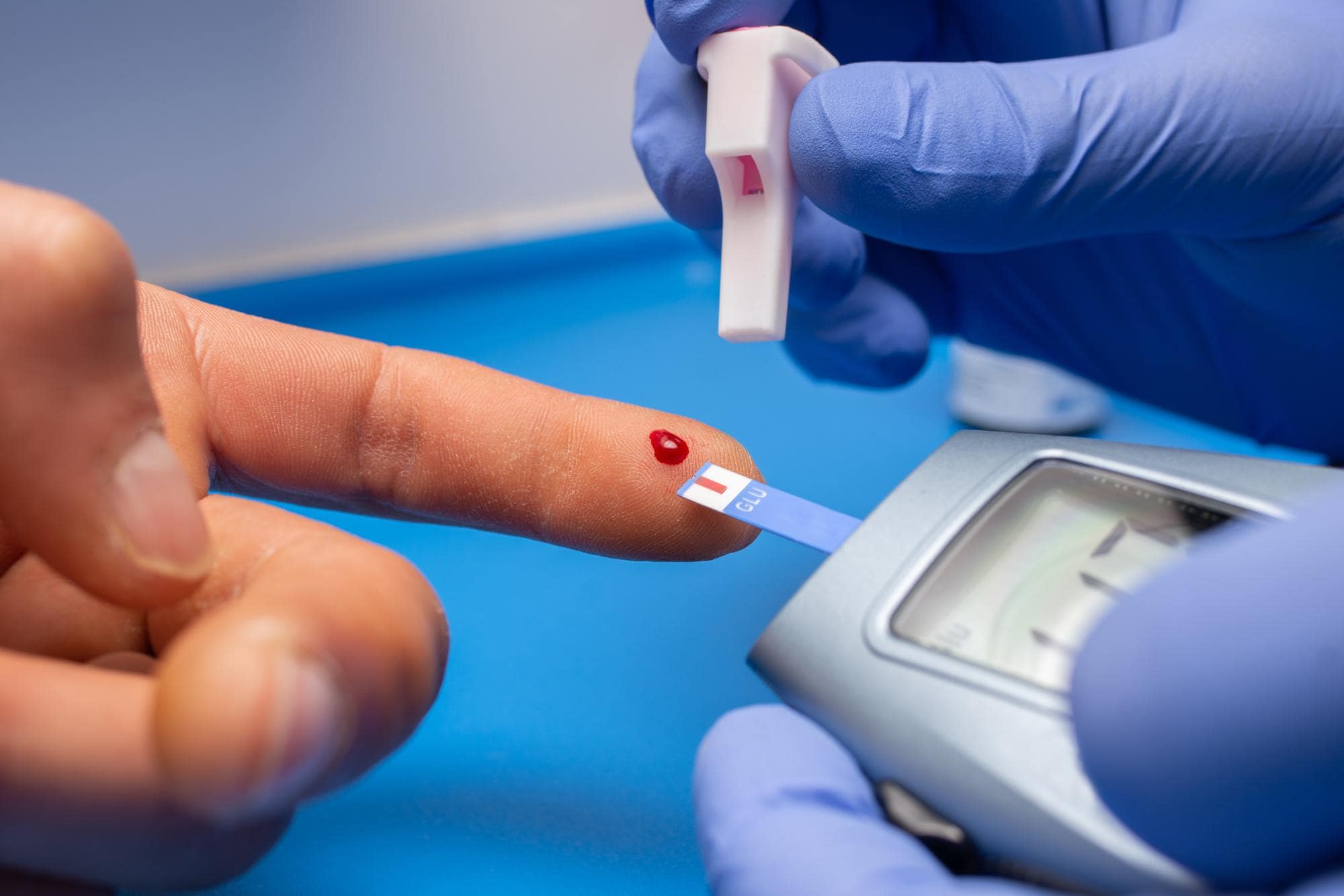 Top Diabetologist in Patna, best sugar specialist doctor in patna, best diabetologist in patna, diabetes doctor in patna, cardiologist doctor, blood pressure doctor in patna, best physician in patna, gastrologist doctor in patna, best heart doctor in patna, best rheumatologist in patna, Best Diabetes Doctor in Patna, thyroid specialist doctor in patna, pulmonologist doctor in patna